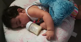 سندرم شیشه شیر چیست؟