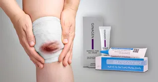 بهترین ترمیم کننده زخم باز