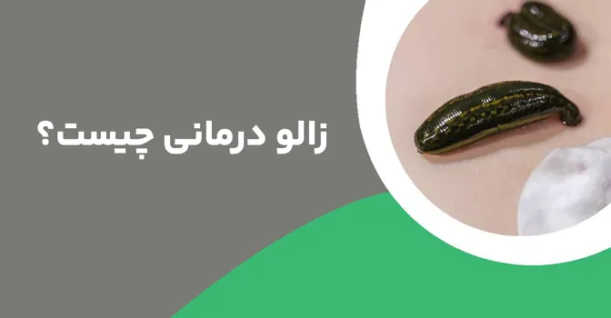 زالو درمانی چیست و باید زیر نظر چه کسانی انجام شود؟