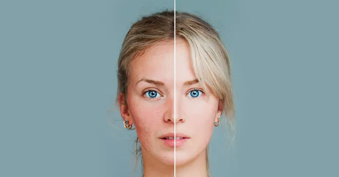 8 علت قرمزی پوست صورت چیست؟