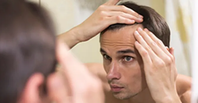 راه‌های درمان ریزش موی مردان