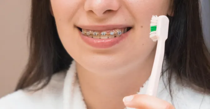 آموزش قدم به قدم مسواک زدن دندان های ارتودنسی شده