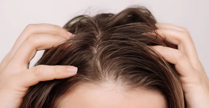 علت چرب شدن کف سر و راه‌های درمان آن