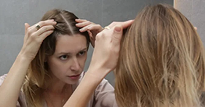 14 نکته برای مراقبت از پوست سر و جلوگیری از شوره