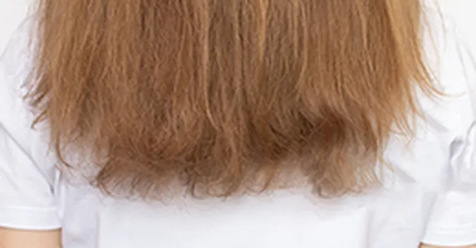 دلایل اصلی خشکی مو چیست و چگونه می‌توان آن را درمان کرد؟