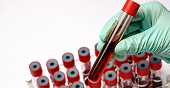 FDA یک نوع تست خون را برای غربالگری سرطان کولورکتال (سرطان روده بزرگ) تأیید می‌کند!